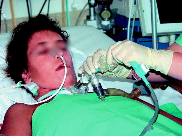 graphic file with name 6376_9_De_55_Fig11_HTML.jpg