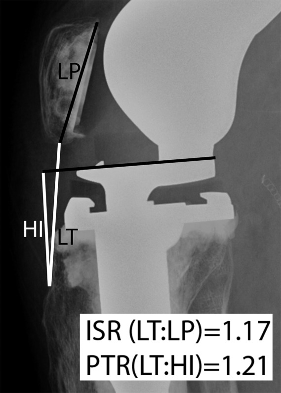 Fig. 1-A