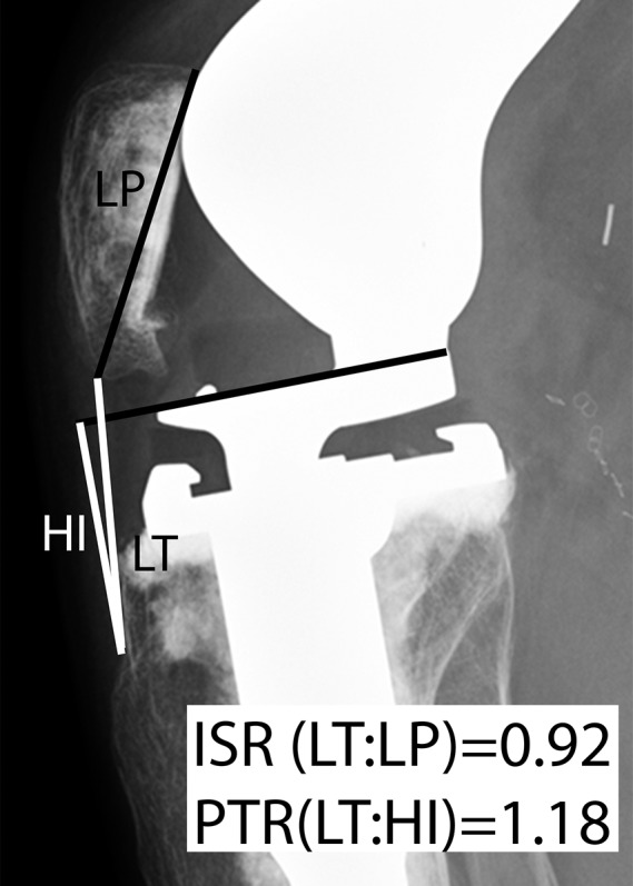 Fig. 1-B