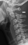 Fig. 10.