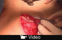 Video Graphic 1.