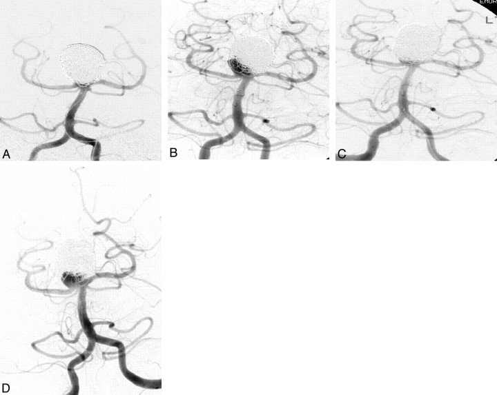 Fig 5.