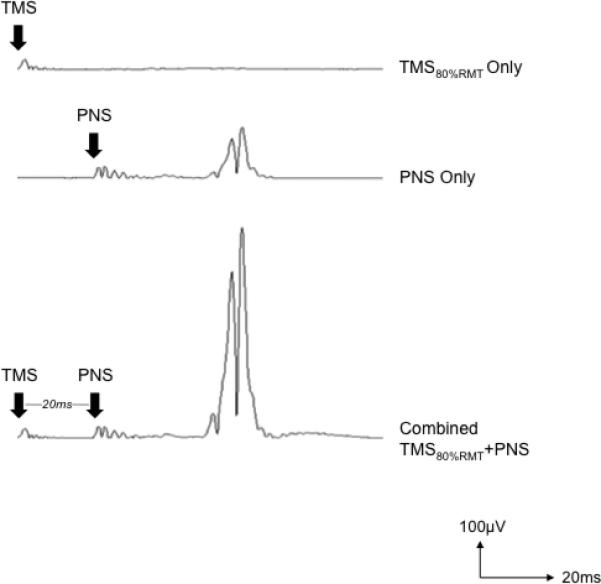 Fig 2a