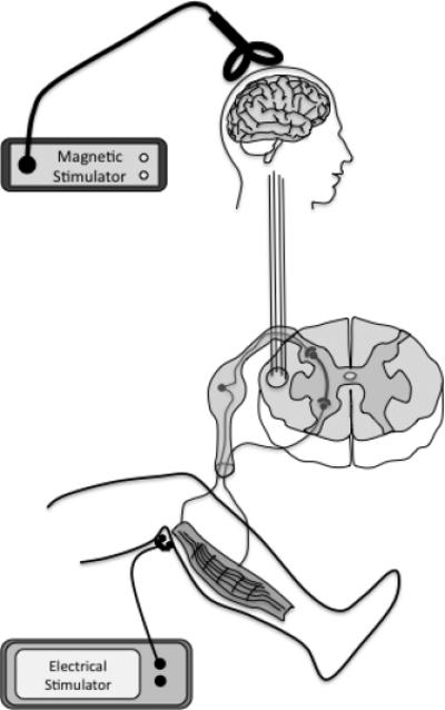 Fig 1a