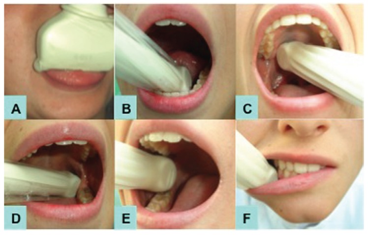 Figure 2