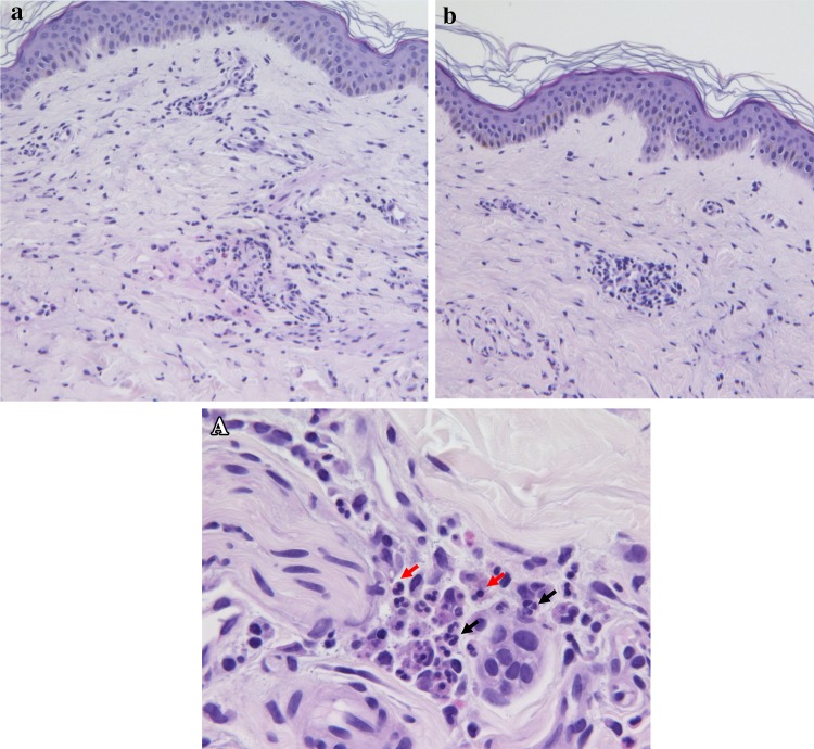 Fig. 3