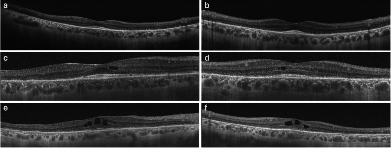 Fig. 4