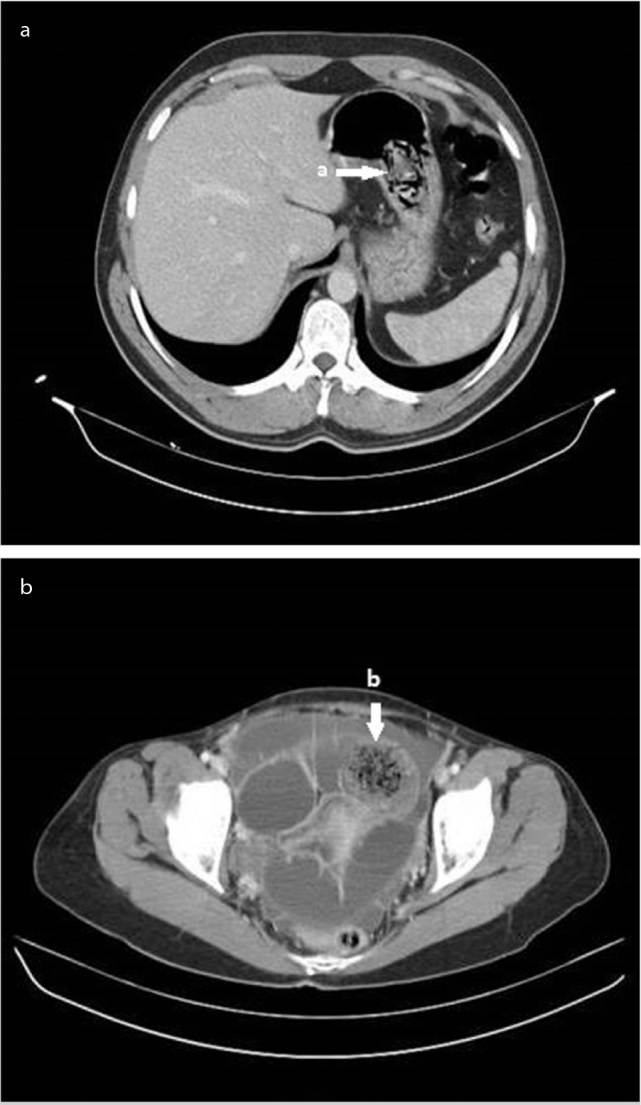 Figure 2. a, b