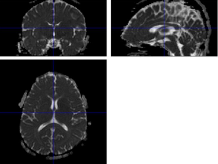 Fig. (2)