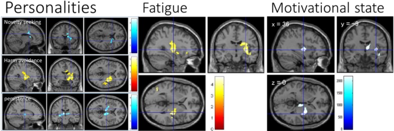 Fig. (4)