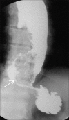 Figure 18