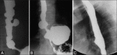 Figure 3 (A-C)