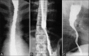 Figure 11 (A-C)