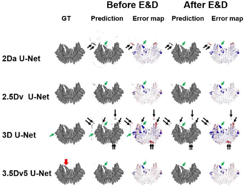 Figure 11