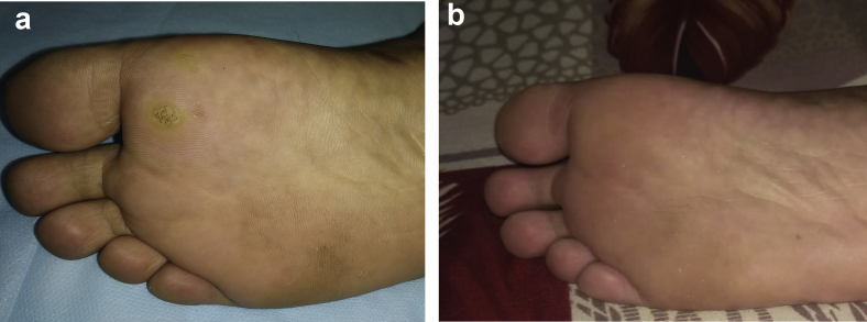 Fig. 3