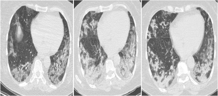 Fig. 5