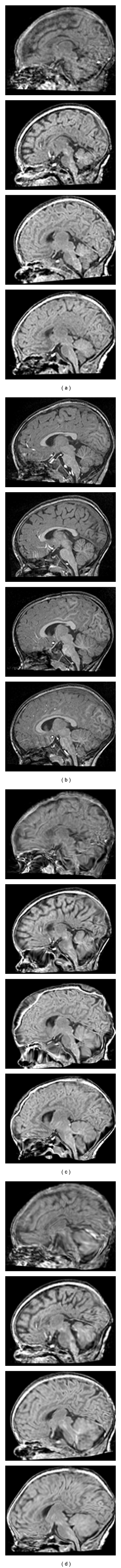 Figure 11