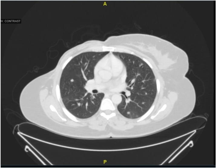 Fig. 10