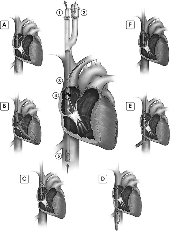 Figure 1: