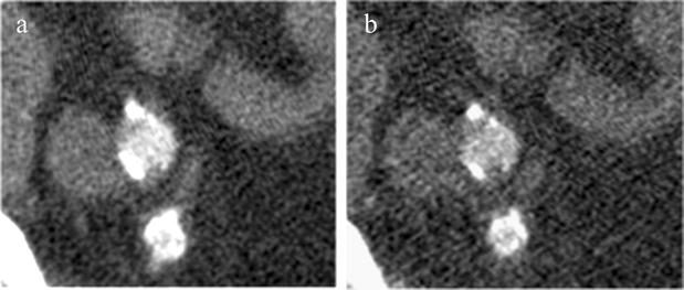 Fig. 3a, b