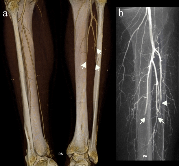 Fig. 10a, b