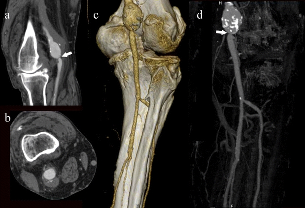 Fig. 11a–d