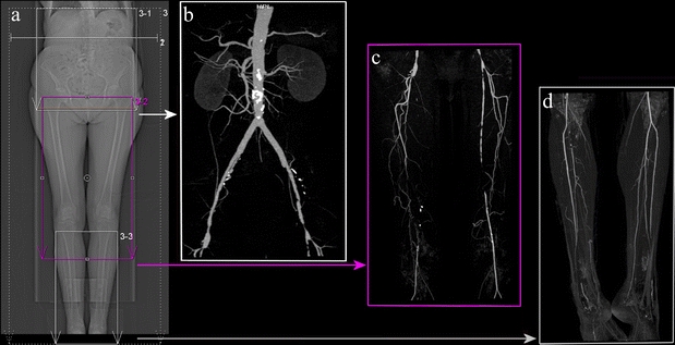 Fig. 1