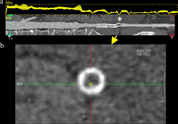 Fig. 9a, b