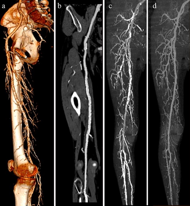 Fig. 6a–d