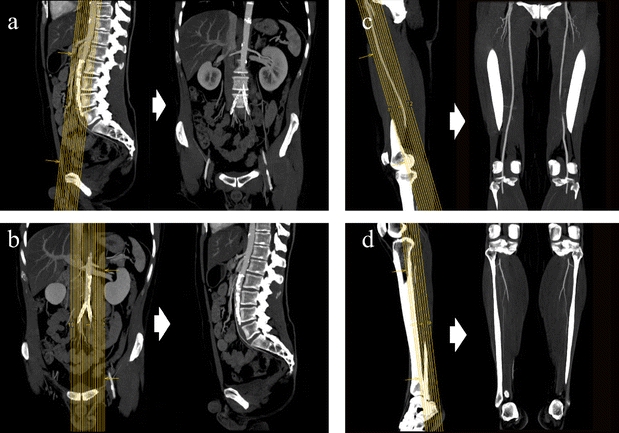 Fig. 4a–d