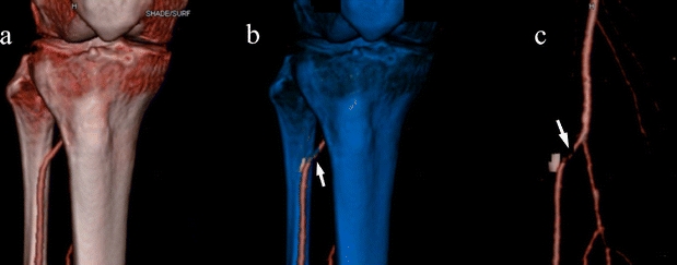 Fig. 8a–c