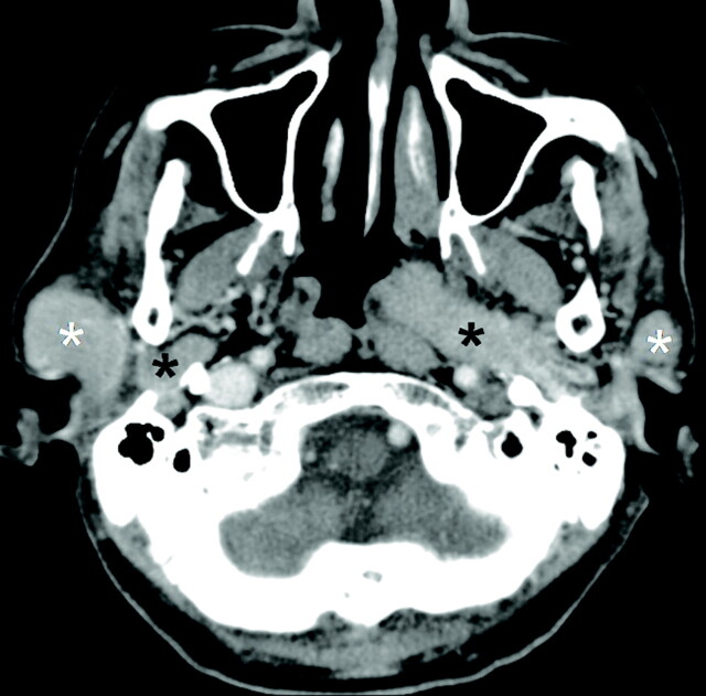 Fig 1.