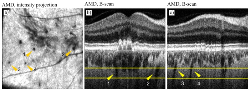 Fig. 9