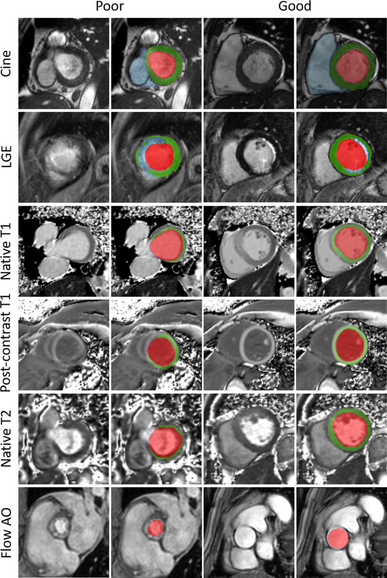 Fig. 4