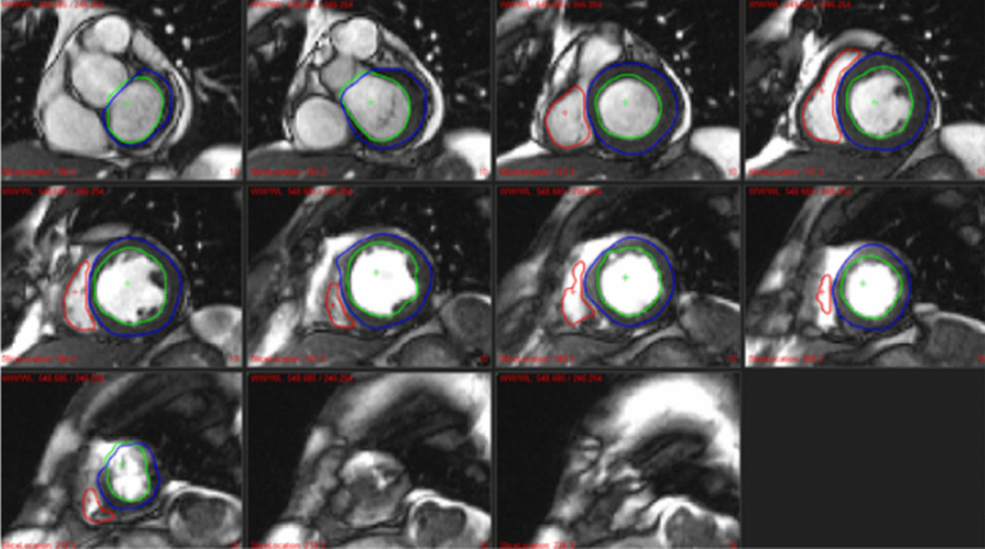 Fig. 9