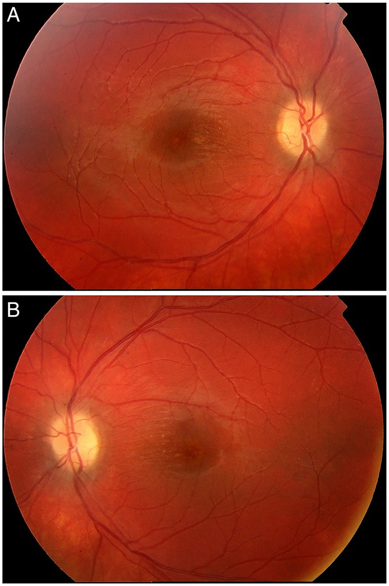 Figure 4