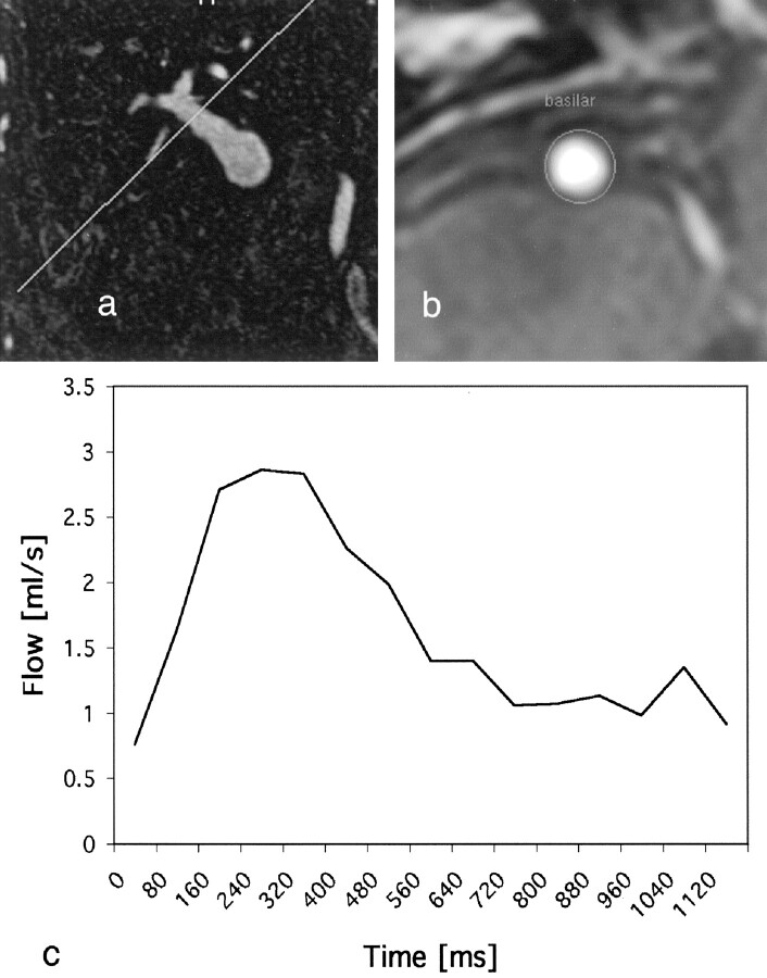 Fig 2.