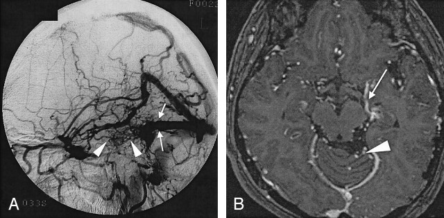 Fig 3.