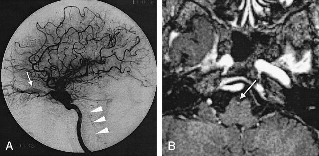 Fig 4.