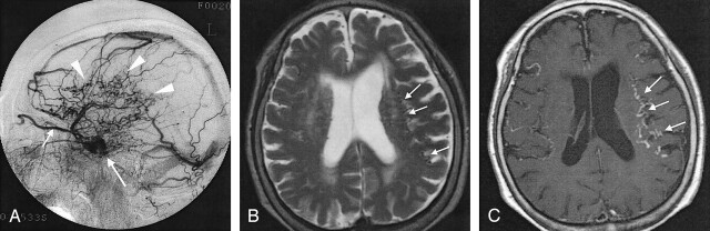 Fig 1.