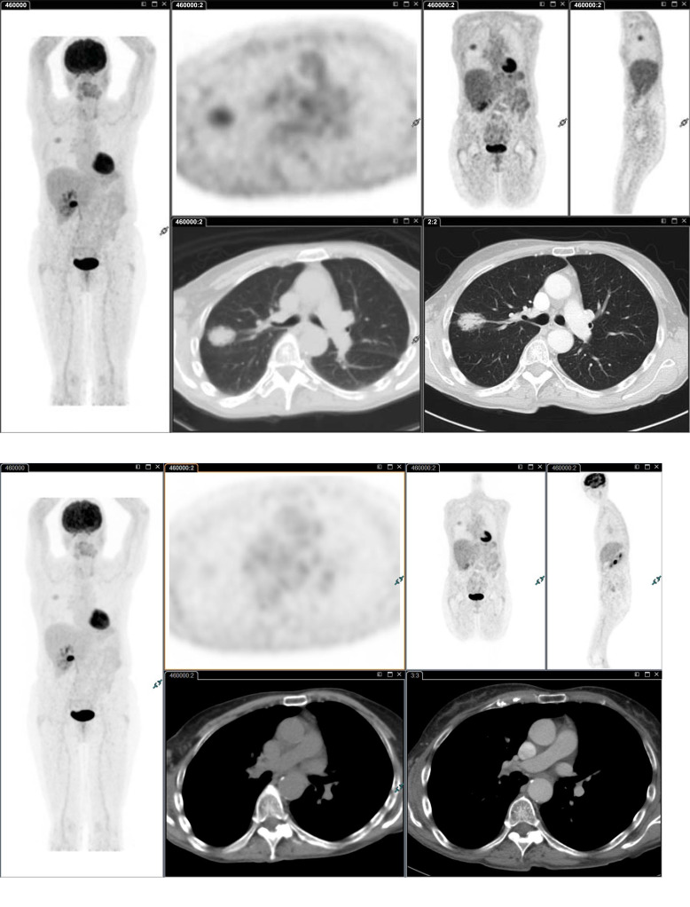 Fig. (2)