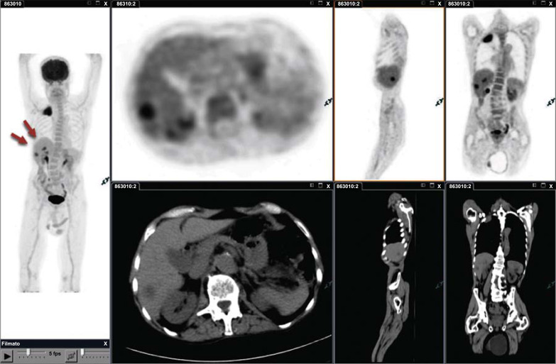 Fig. (5)