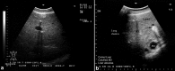 Fig. 16.