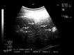 Fig. 14.