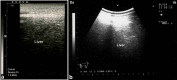 Fig. 12.