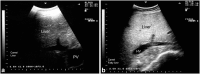 Fig. 11.