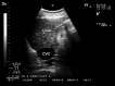 Fig. 17.