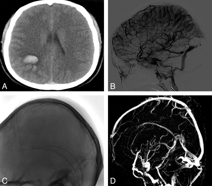 Fig 1.