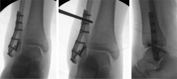 Fig. 6