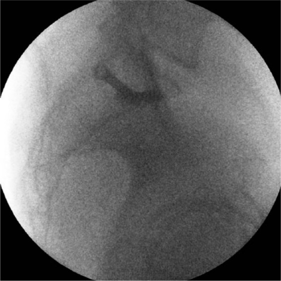 Fig. 2
